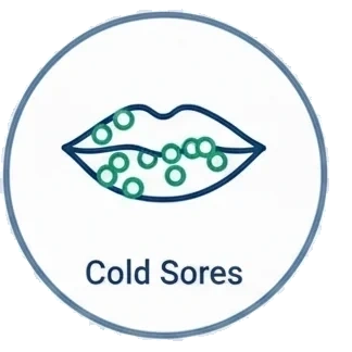 Cold Sores