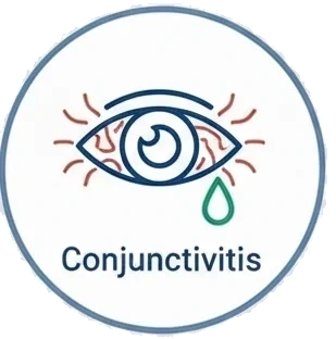 Conjunctivitis