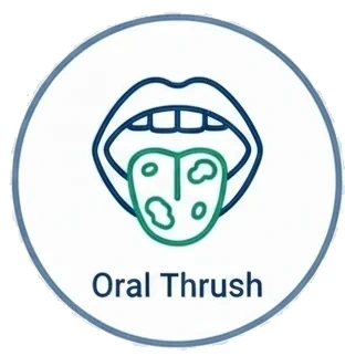 Oral Thrush