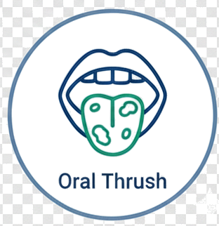 Oral Thrush