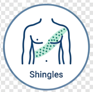 Shingles